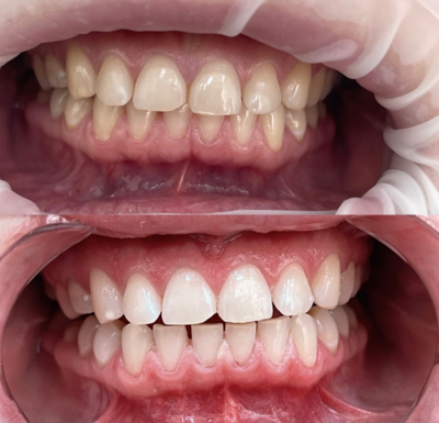 Улыбайтесь чаще! Стоматологическая клиника дарит скидку до 40% Улыбайтесь чаще! Стоматологическая клиника дарит скидку до 40%