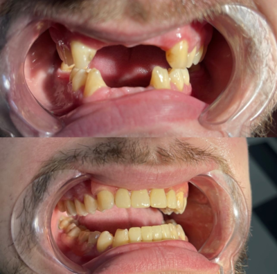 Улыбайтесь чаще! Стоматологическая клиника дарит скидку до 40% Улыбайтесь чаще! Стоматологическая клиника дарит скидку до 40%