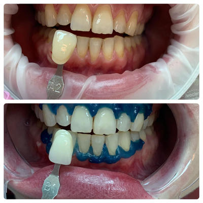 Улыбайтесь чаще! Стоматологическая клиника дарит скидку до 40% Улыбайтесь чаще! Стоматологическая клиника дарит скидку до 40%