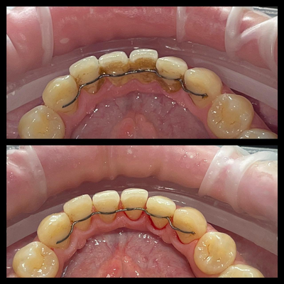 Улыбайтесь чаще! Стоматологическая клиника дарит скидку до 40% Улыбайтесь чаще! Стоматологическая клиника дарит скидку до 40%