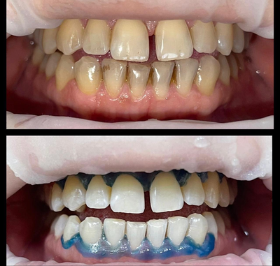 Улыбайтесь чаще! Стоматологическая клиника дарит скидку до 40% Улыбайтесь чаще! Стоматологическая клиника дарит скидку до 40%