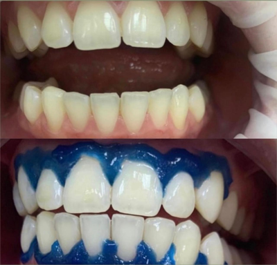 Улыбайтесь чаще! Стоматологическая клиника дарит скидку до 40% Улыбайтесь чаще! Стоматологическая клиника дарит скидку до 40%