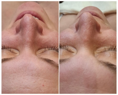 Косметологические процедуры со скидкой до 52% Косметологические процедуры со скидкой до 52%