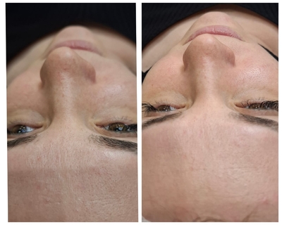 Косметологические процедуры со скидкой до 52% Косметологические процедуры со скидкой до 52%