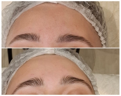 Косметологические процедуры со скидкой до 52% Косметологические процедуры со скидкой до 52%